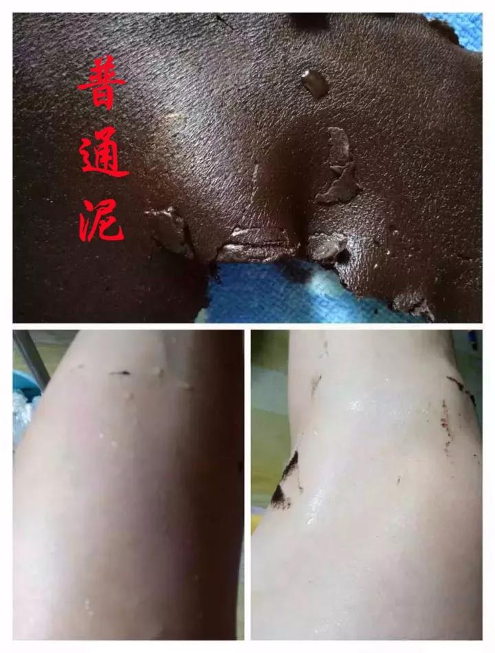 泥疗机.jpg